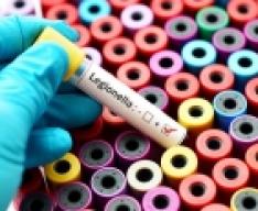 Legionella